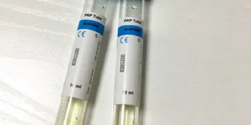 Advantages of purchasing PRP tubes in PlasmoLifting