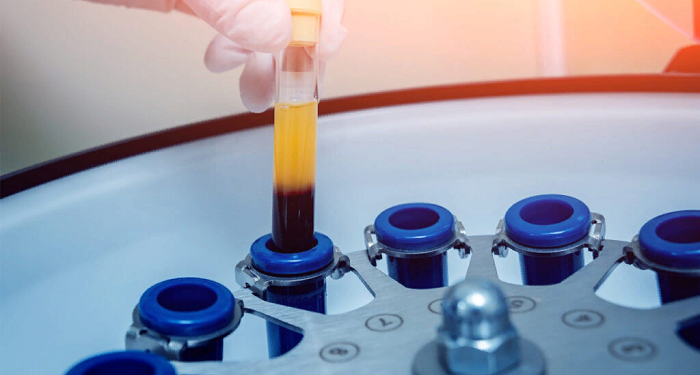 PRP Courses: concept, essence and purpose